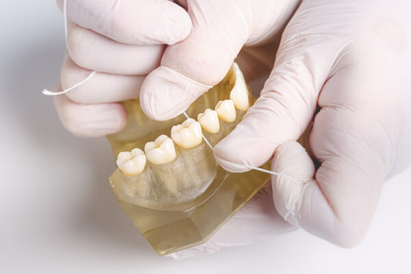 Professionelle Zahnreinigung