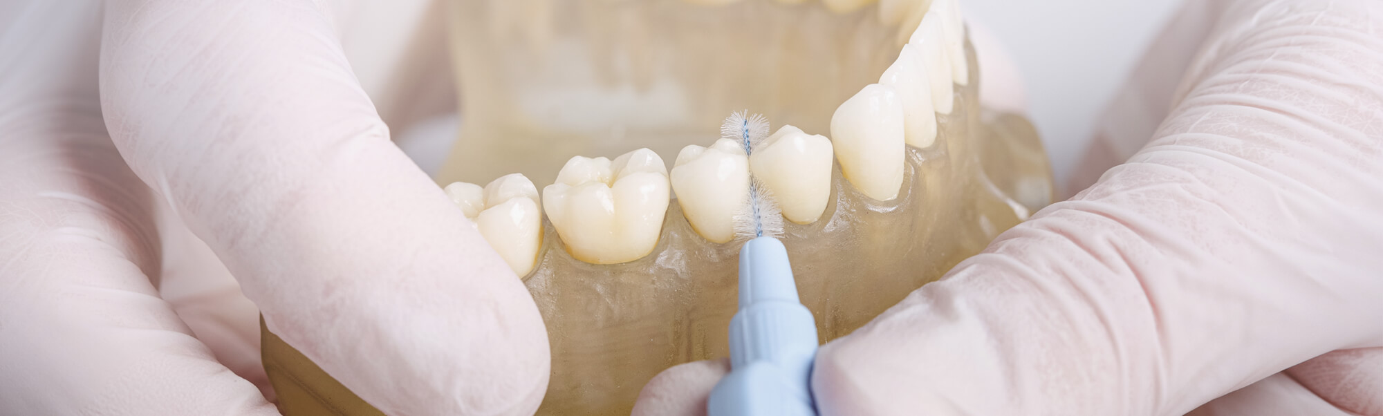 Zahnärztliche Prophylaxe & Zahnreinigung